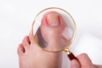 Facts About Ingrown Toenails